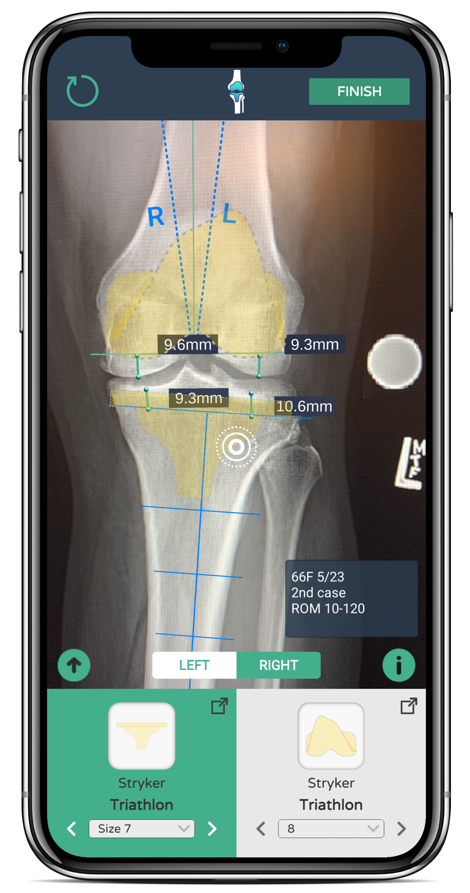 Devise Health portfolio image 1