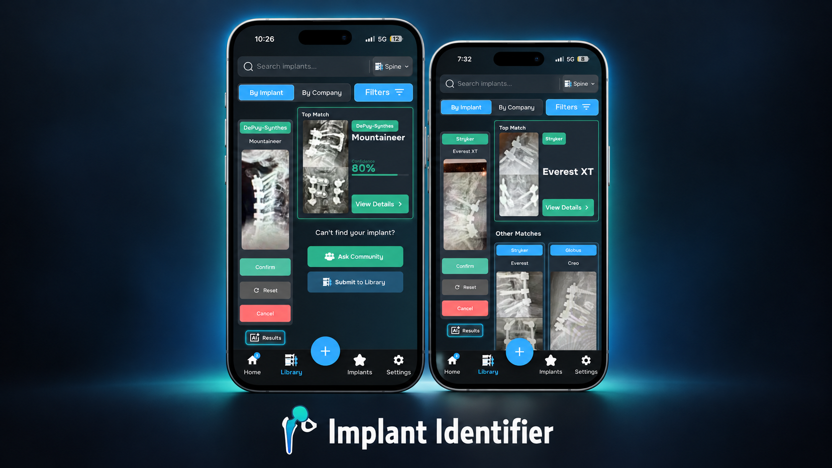 Implant Identifier app shown on two iPhone mockups